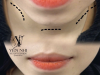 GIÚP BẠN ĐẸP HƠN TỪNG ĐƯỜNG NÉT TẠI YẾN NHI BEAUTY CENTER
