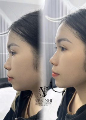 LÀM ĐẸP UY TÍN TẠI GÒ VẤP