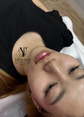 BÍ QUYẾT LÀM ĐẸP KHÔNG CẦN PHẪU THUẬT TẠI YẾN NHI BEAUTY CENTER