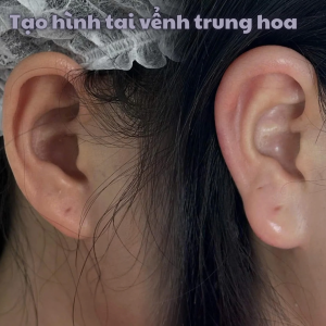 Album ảnh
