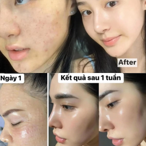 Album ảnh