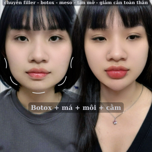 Album ảnh