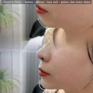 Album ảnh