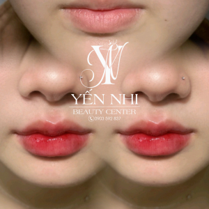Album ảnh