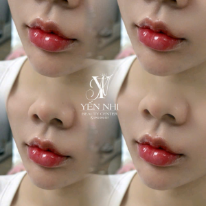Yến Nhi Beauty Center