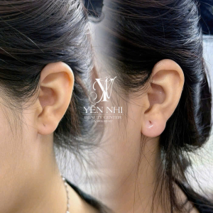 Yến Nhi Beauty Center