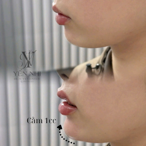 Album ảnh