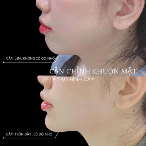 Album ảnh