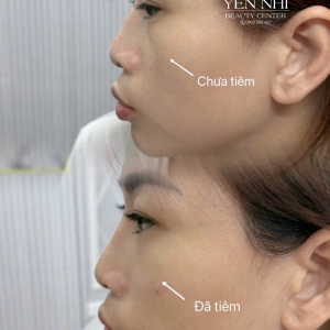 Album ảnh