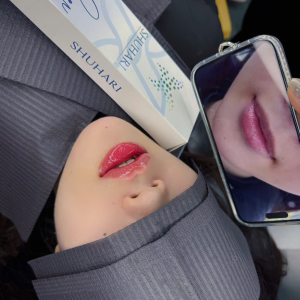 Album ảnh