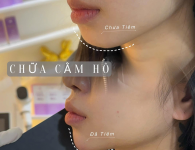 Filler Hàn