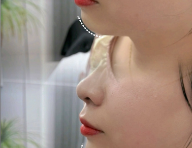 Filler Hàn