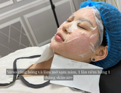 Meso căng bóng