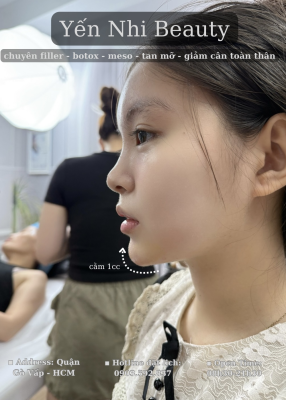 F.Juvederm